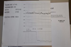 Расшифровка КТГ 40 недель