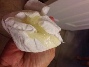 На 5 день менструации выделения усилились