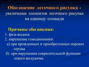 Обогащение легочного рисунка