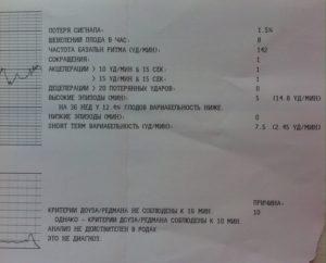 Критерии ктг не соблюдены, причина 1