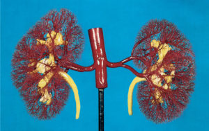 Синдром Фрейли