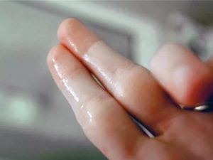 Выделения стали жидкими как вода