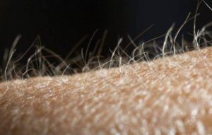 Ощущение что по лицу голове и телу бегает что то