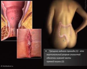 Белая пена из заднего прохода