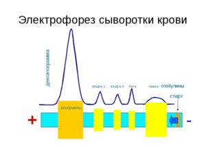 Электрофорез и плохой анализ крови
