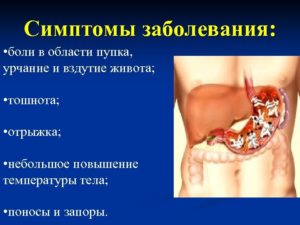 Метеоризм, отрыжка, урчание в кишечнике