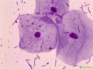 Безъядерные клетки плоского эпителия