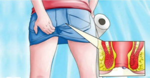 Застряла в попе свечка