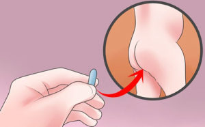 Застряла в попе свечка