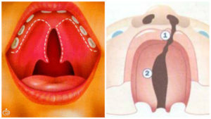 Готическое нёбо
