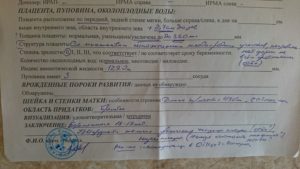 Визуализация затруднена