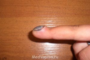 Прищемила палец дверью машины