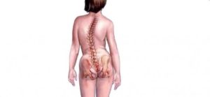 Остеохондроз шоп и поп