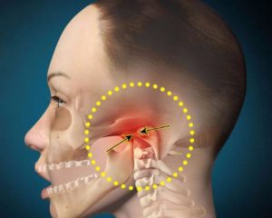 Боль чувство расписания под челюстью и ниже