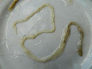 Вытянул длинного червя, с заднего прохода