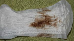 Выделения при приеме жанина