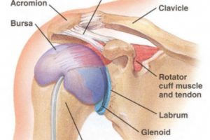 Не поднимается левая рука