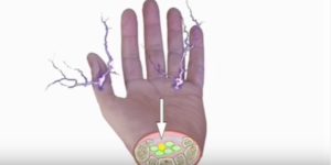 В большом пальце руки ощучение что бьет током