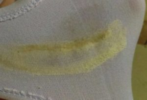 Желтые выделения с кислым запахом