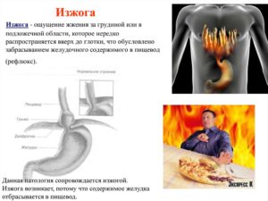 Изжога, отрыжка, жжение в желудке