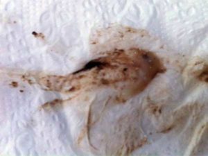 Коричневые выделения после месячных, набухла грудь