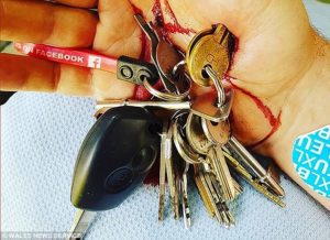 Проткнул отверткой Руку что делать