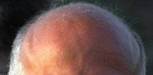 Ощущение что по лицу голове и телу бегает что то