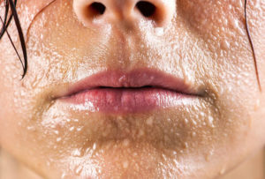 Ощущение что по лицу голове и телу бегает что то