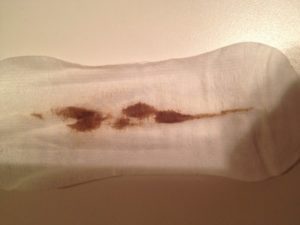 Коричневые выделения после месячных, набухла грудь