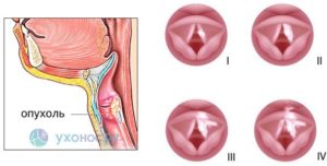 Пропадает голос к вечеру