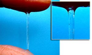 Выделения стали жидкими как вода