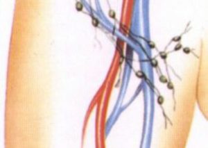 Прощупывается лимфоузел в паху