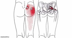 Болит поясница и тянет ноги