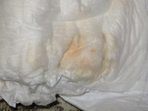 На 5 день менструации выделения усилились