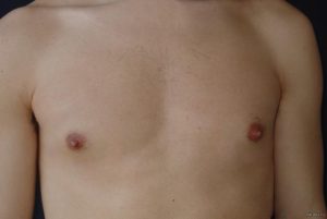 Выпуклые ореолы