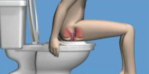 Нужно ли вставлять свечу заново при геморрое после туалета