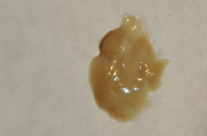 Откашливаются коричневые куски