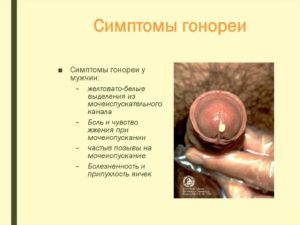 Возможно ли заразиться трихомонадой и гонореей через оральный секс?