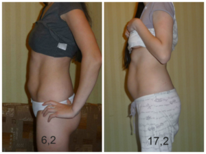 Нет шевелений в 17 недель