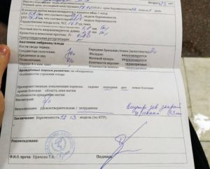 Визуализация затруднена