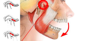 При сжатии челюсти боль отдает в ухо