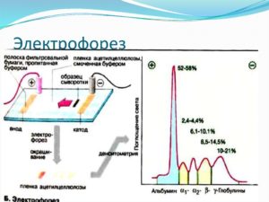 Электрофорез и плохой анализ крови