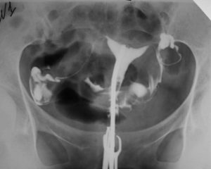 Ограничения после Гсг