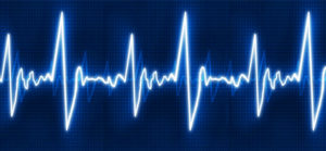 Резкие Скачки пульса