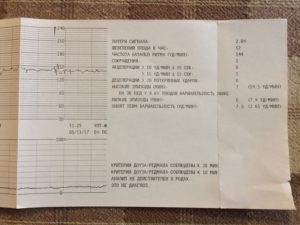 Критерии ктг не соблюдены, причина 1