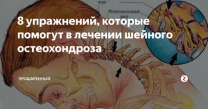 Шум в ушах, остеохондроз