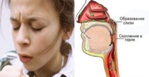 Постоянная сухость и присутствие слизи в глотке