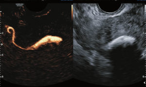 Визуализируется труба