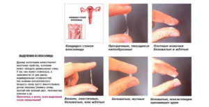 Нет выделений во влагалище