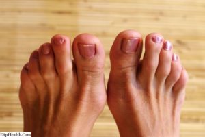 Болят пальчики на ножках